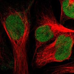 ZNF22 Antibody, Novus Biologicals:Antibodies:Primary Antibodies